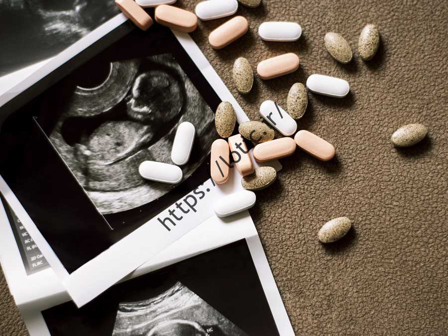 علائم سقط جنین و روش های آن توسط متخصص زنان